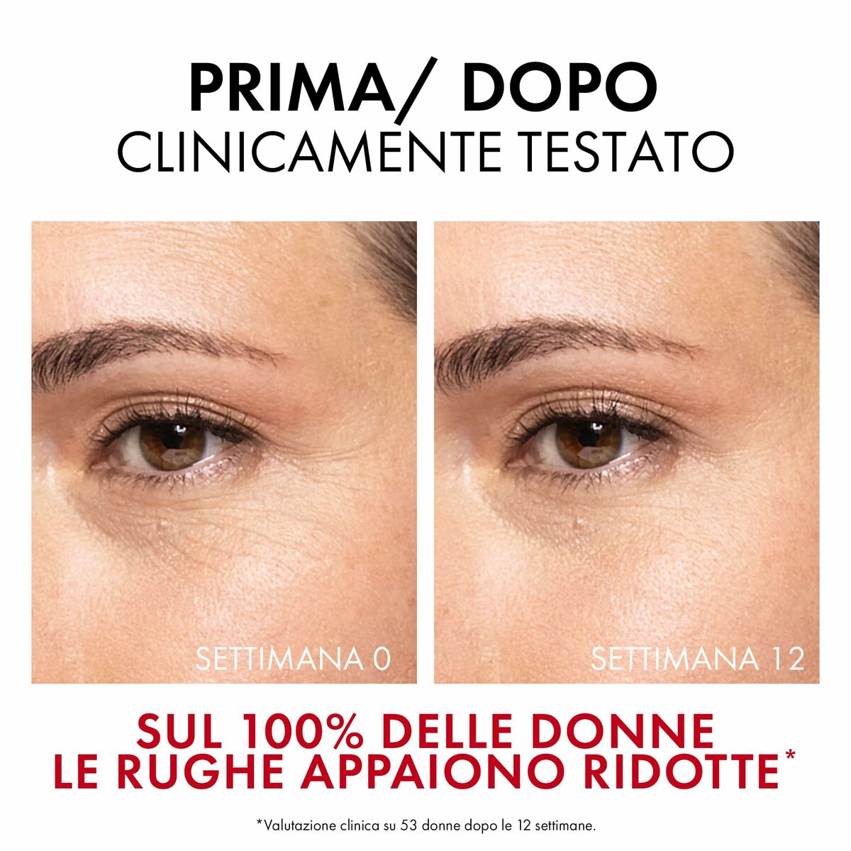 V3H5153FCB256D0A8860B1BA12466512AE5R5608852P4